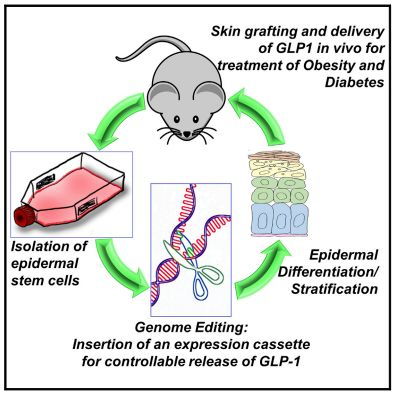 糖尿病最新研究進展 工程與技術驅動的革命性突破